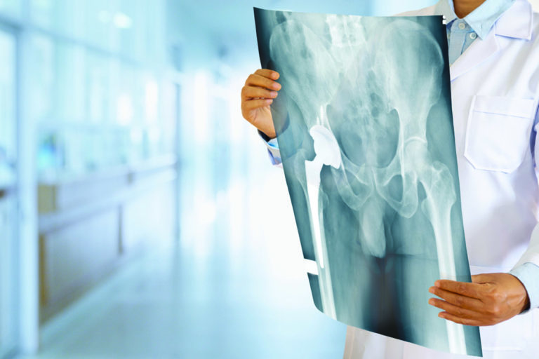 bursa pelvik taban rehabilitasyonu